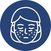 lupus