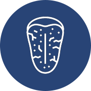 sjogren's syndrome